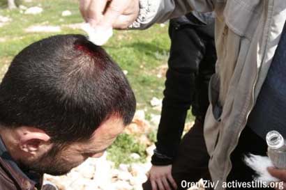 Bil'in : Un manifestant blessé à la tête avec la crosse d'un fusil